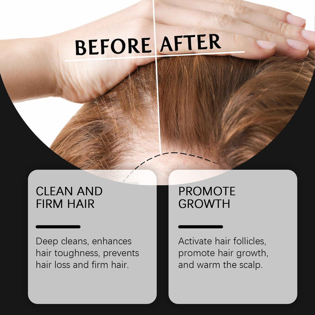 Hoegoa Rice Shampoo Scalp Cleansing Nourish Hair Repair Hair Follicles Smooth Hair Shampoo