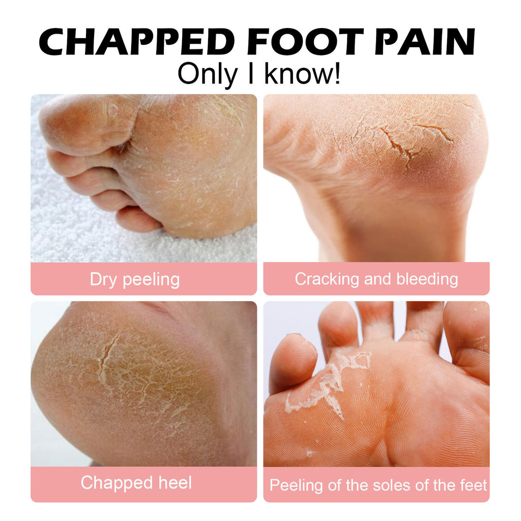 Hoygi Hand and Foot Moisturizing Stick, Foot Care, Hand and Foot Skin Moisturizing and Hydrating Stick